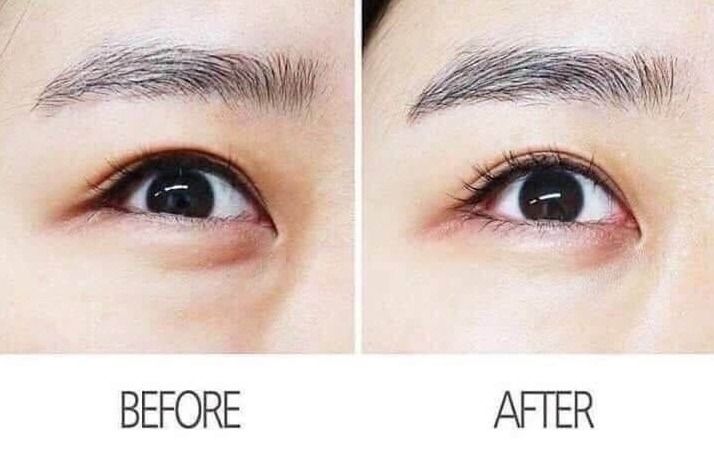 AHC Premier Ampoule Eye Cream for Face Line Tightening 12ml.