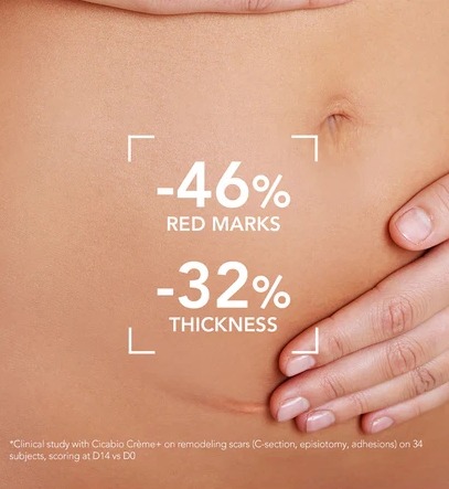 แพ็คเกจใหม่ Bioderma Cicabio Cream+ 100ml.