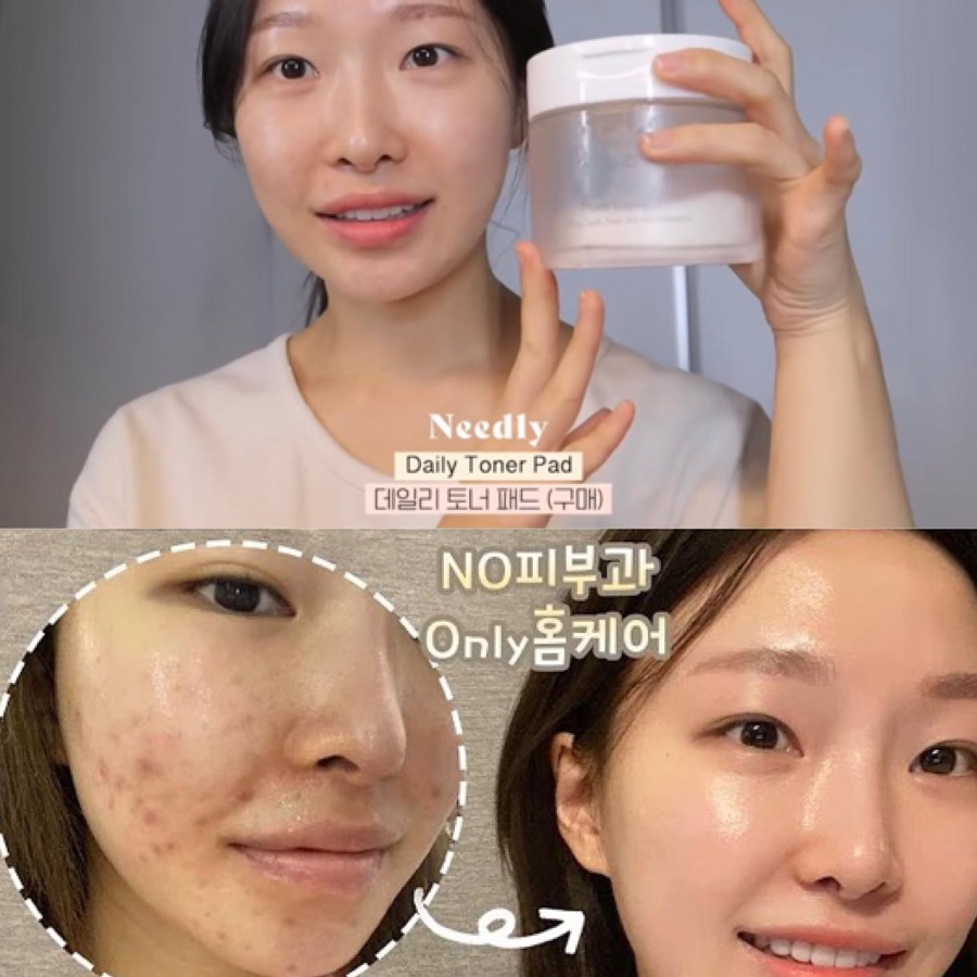 NEEDLY DAILY TONER PAD (จำนวน 60 แผ่น)